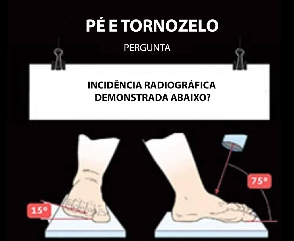 As provas de ortopedia costumam cobrar epônimos